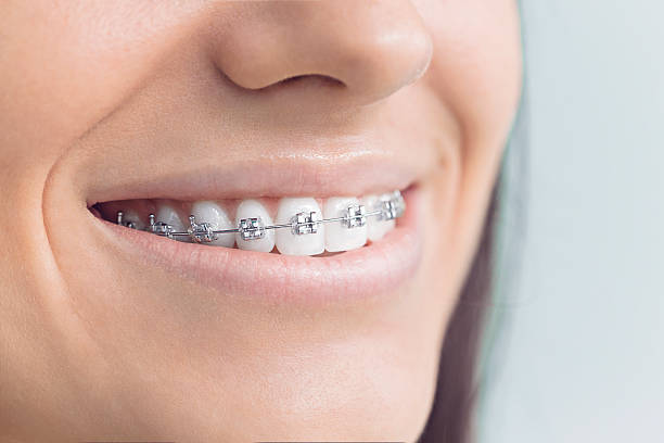 Best Teeth Whitening  in Soap Lake, WA